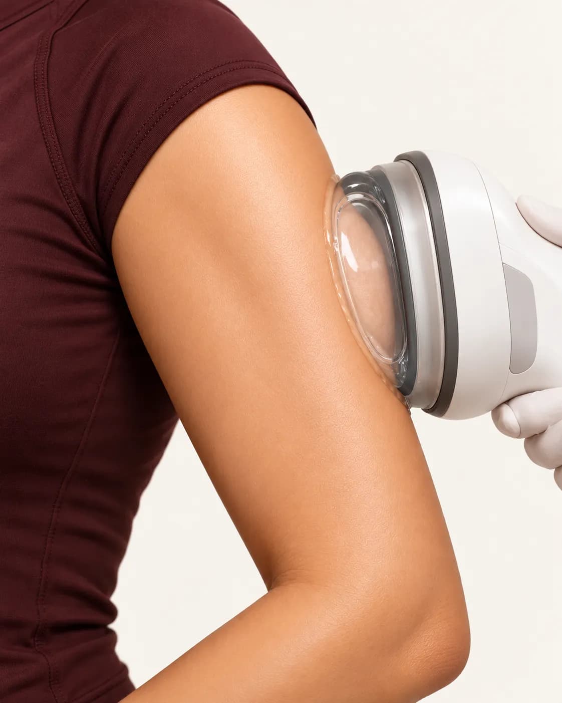 CoolSculpting