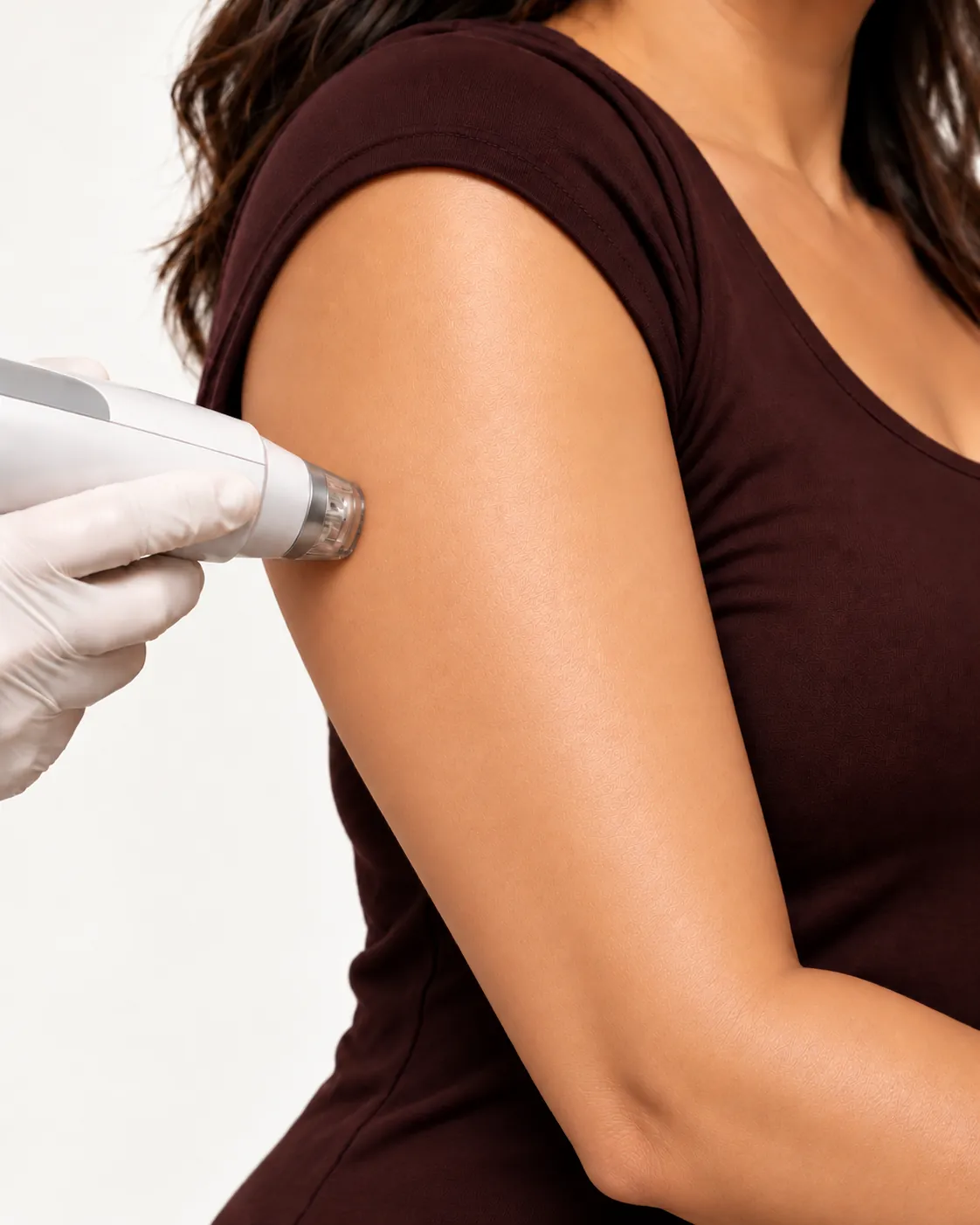 RF-assisted Lipolysis